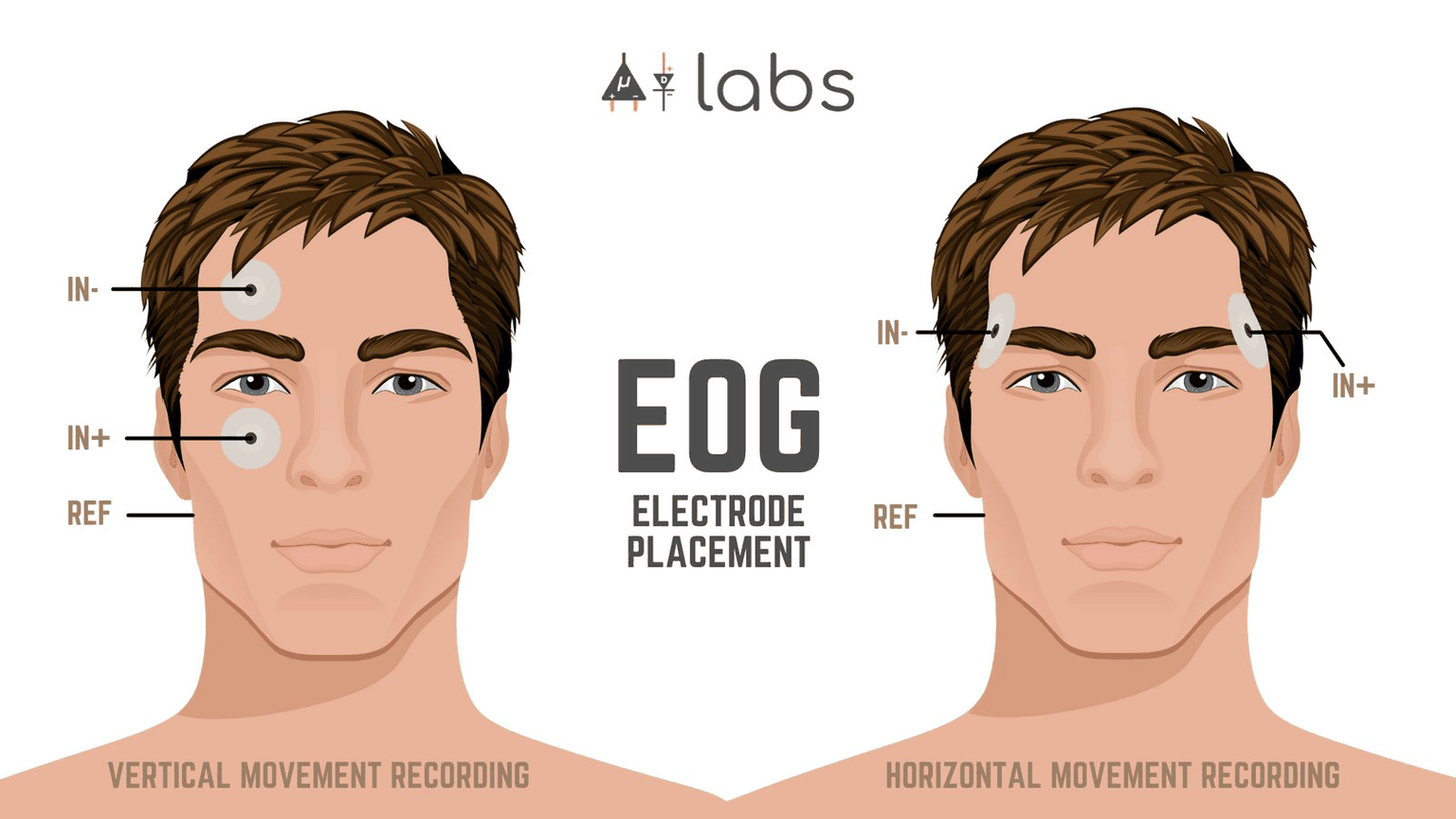 Diagram of EOG electrode placement, showing the vertical configuration above and below the eye and the horizontal configuration at the outer corners